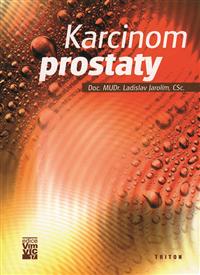 Karcinom prostaty