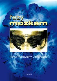 Řezy mozkem